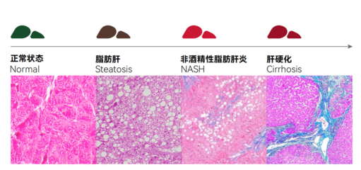 借力AI制藥新科技,LAIFE打造全新肝臟抗老產(chǎn)品